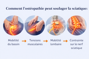 Schéma expliquant comment l’ostéopathie agit sur la mobilité du bassin et des lombaires pour soulager la sciatique